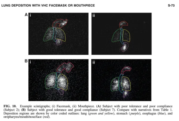 99m con uso de aerocámara relacionado con Cómo se usa el inhalador en kinesiología y fisioterapia