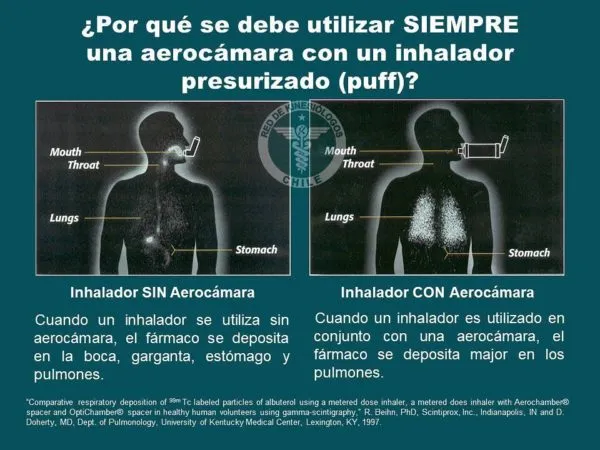 Melani et al relacionado con Cómo se usa el inhalador en kinesiología y fisioterapia