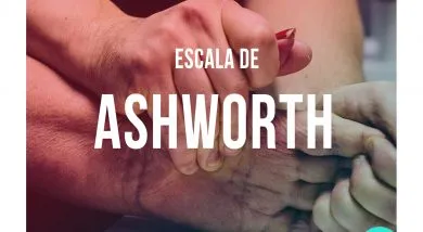 Escala de Ashworth (a)
