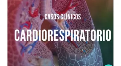 Casos clínicos UC