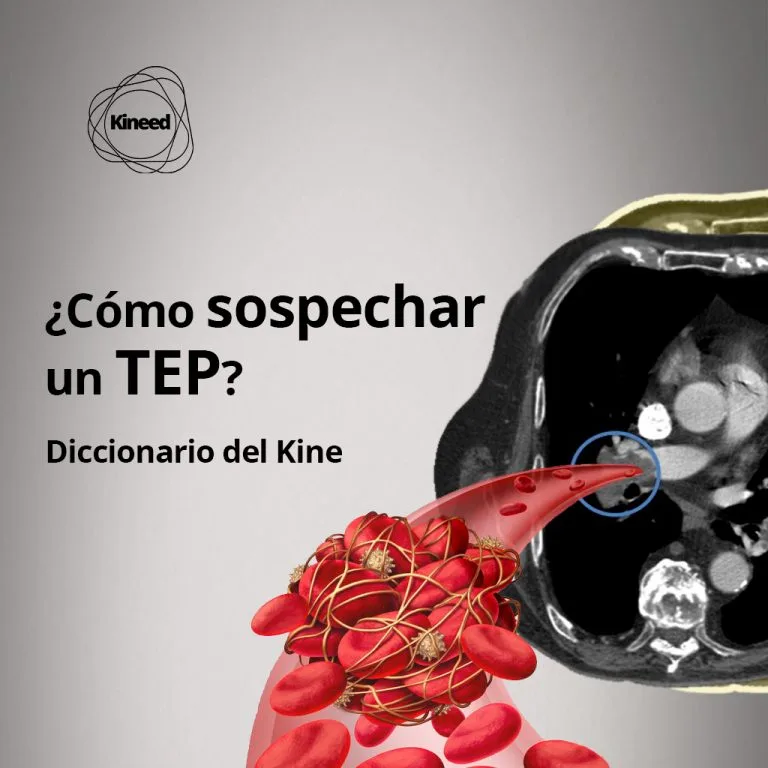 Tromboembolismo pulmonar (TEP)