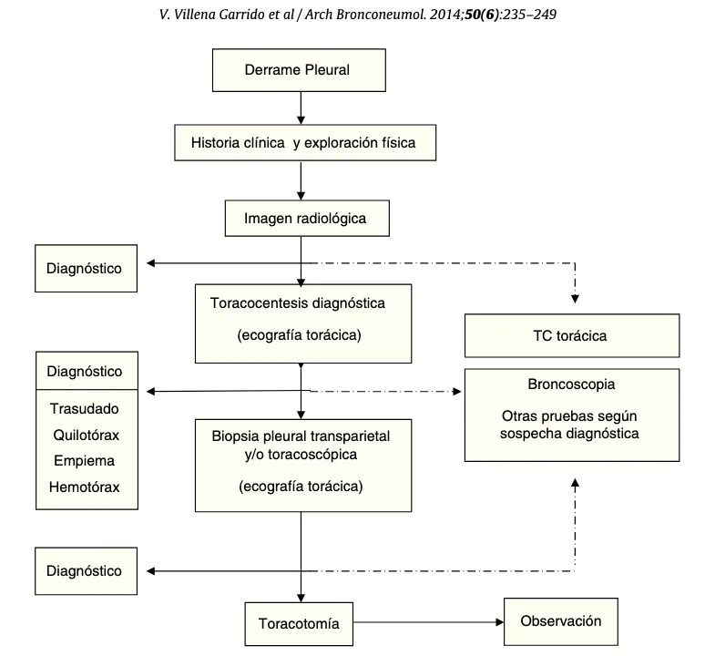 derrame pleural