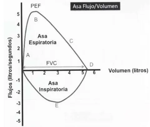 Manual espirometria 2024 relacionado con Cómo se realiza la interpretación de una espirometría en kinesiología y fisioterapia