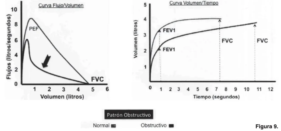 Manual espirometria 2024 relacionado con Cómo se realiza la interpretación de una espirometría en kinesiología y fisioterapia
