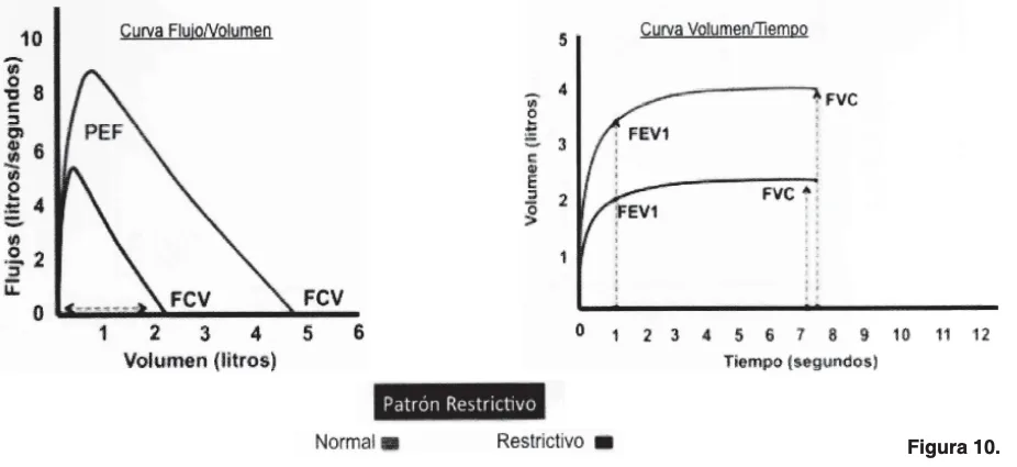 Manual espirometria 2024 relacionado con Cómo se realiza la interpretación de una espirometría en kinesiología y fisioterapia