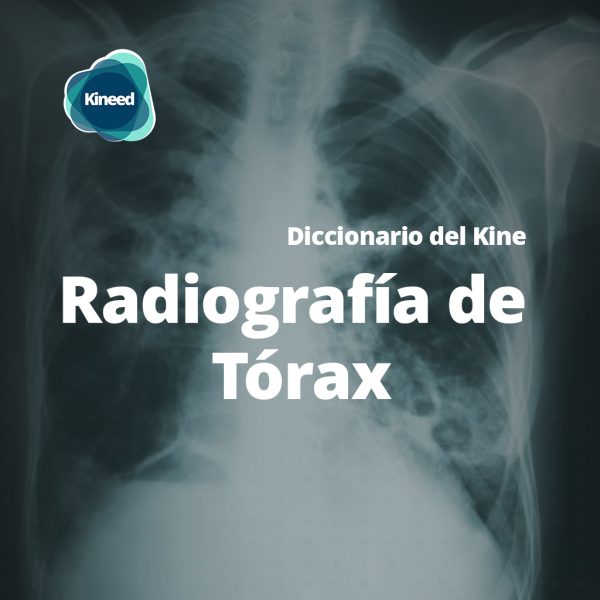 radiografía de tórax