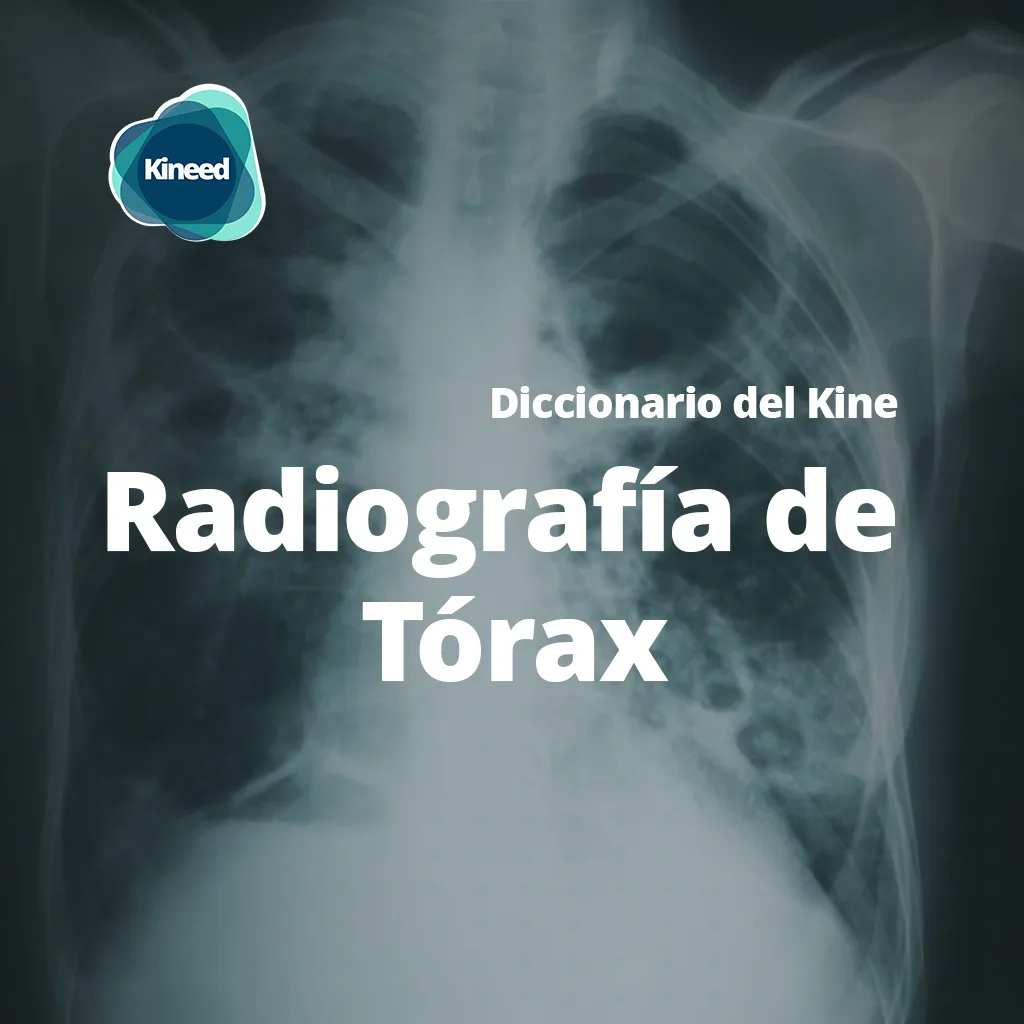 Radiografía de tórax