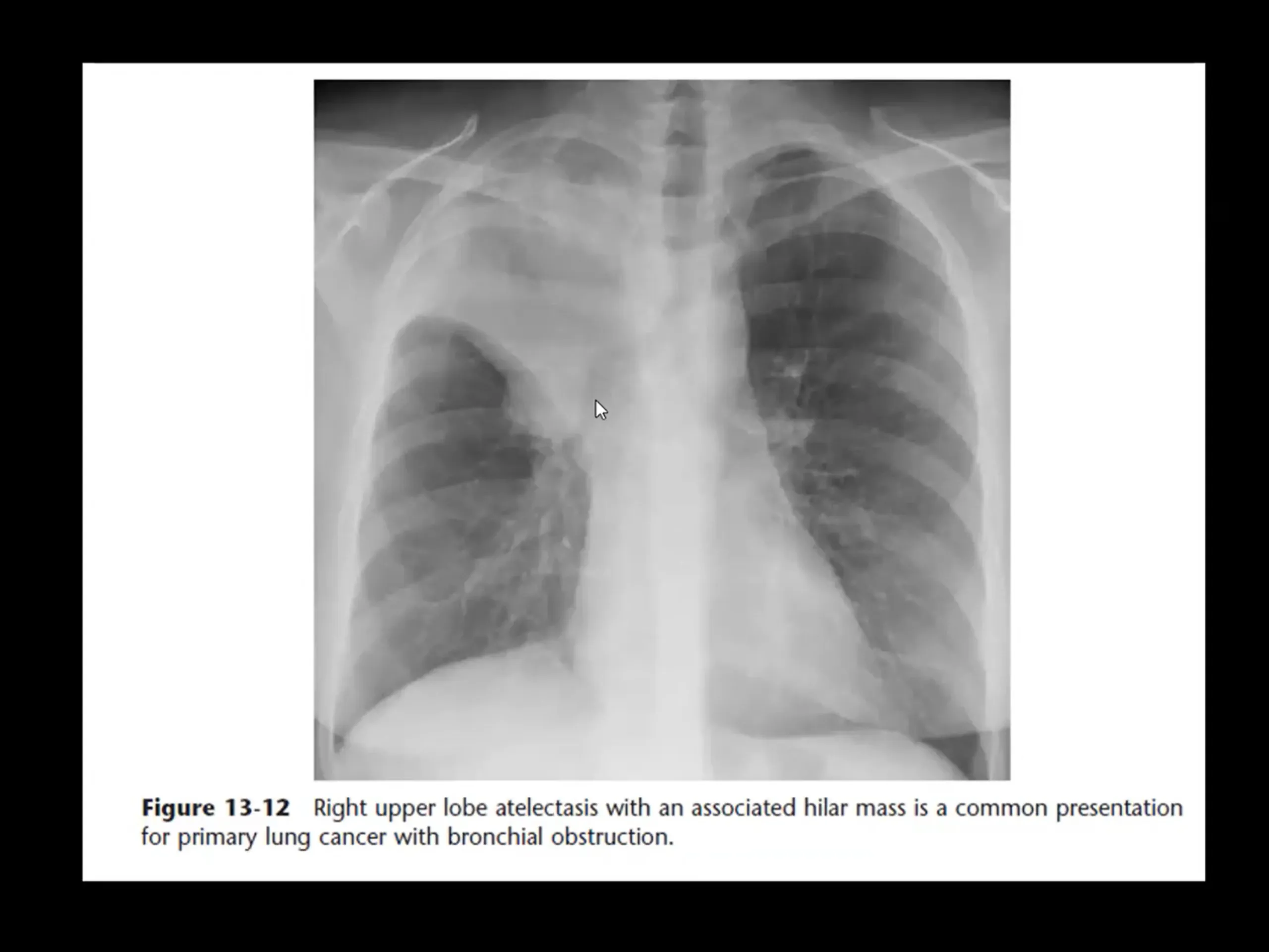 Curso de radiografía de tórax 1