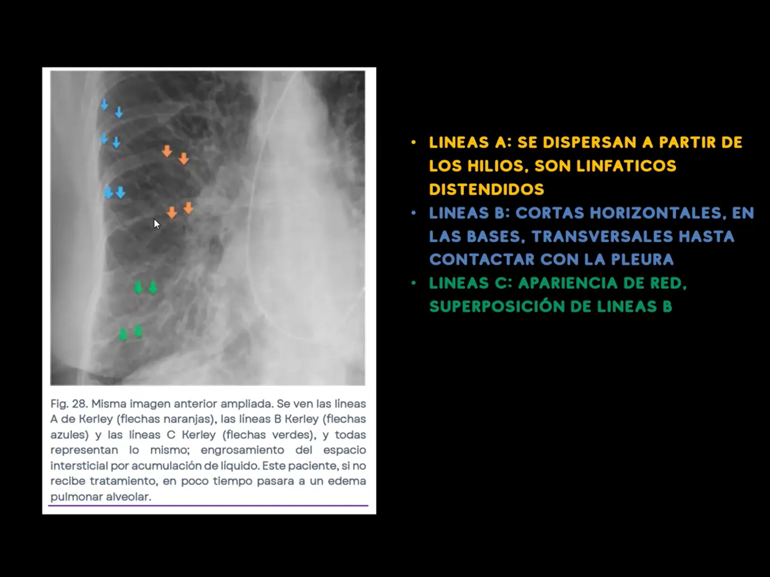 Curso de radiografía de tórax 2