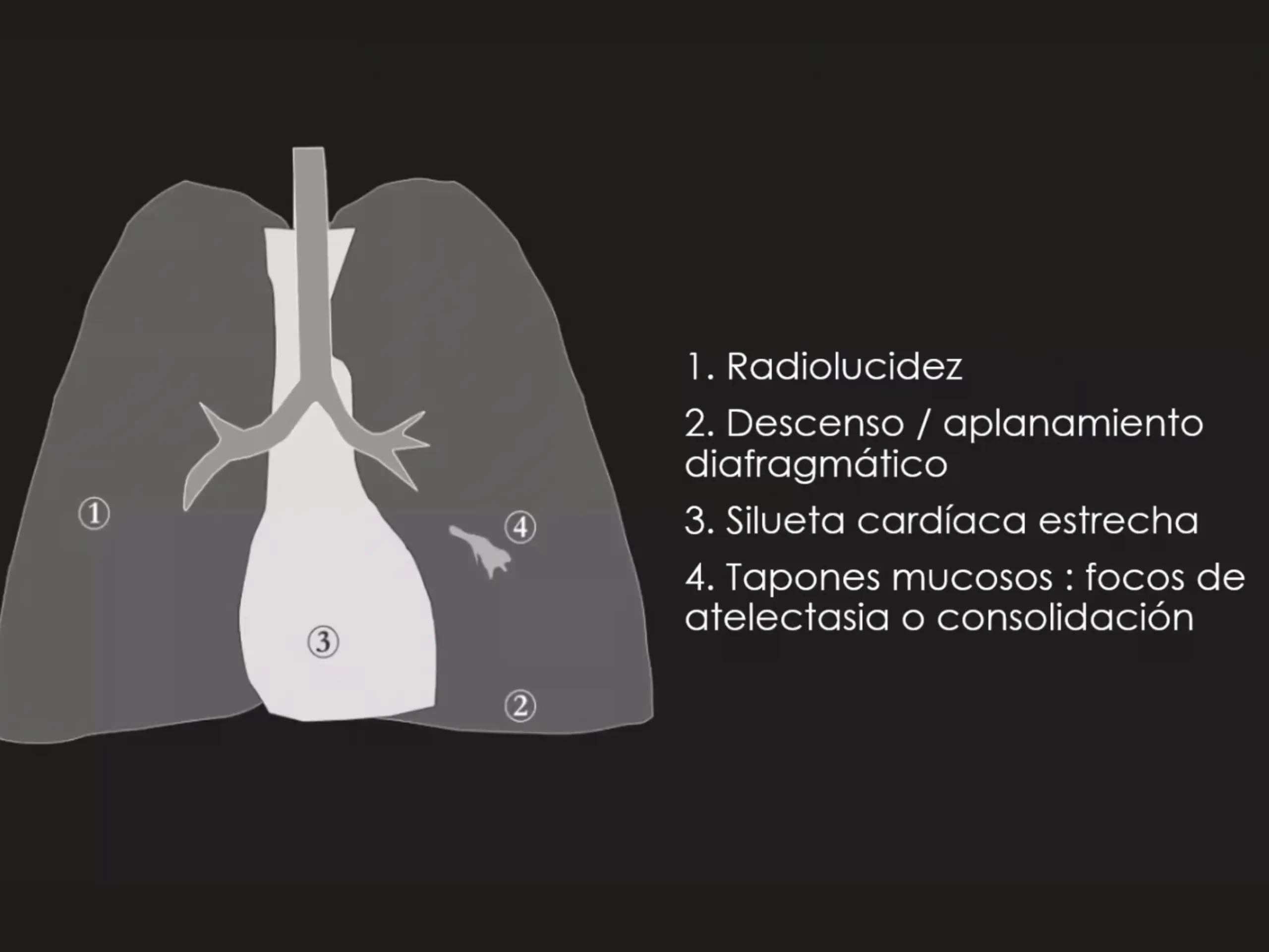 Curso de radiografía de tórax 3
